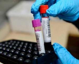 HDL ve LDL Kolesterol Arasındaki Fark Nedir?