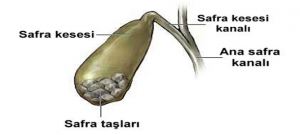 Kolesistit Nedir?