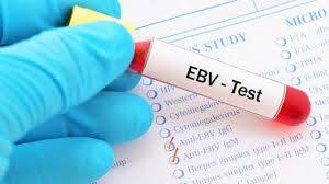 Epstein Barr Virüs Testi Nedir, Neden Yapılır?