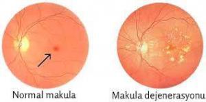 Makula Nedir? Anotomisi, Önemi ve Olası Problemleri Nelerdir?