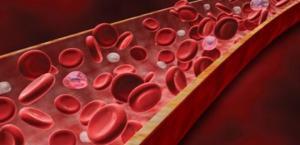 Paroksismal Cold Hemoglobinüri (PCH) Nedir?
