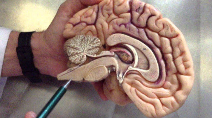 Beyin Sapı Felci Çeşitleri ve Tedavi Şekilleri