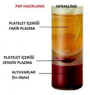 Plazma Tedavisi Nedir? Saç Dökülmesi Tedavisine Nasıl Yardımcı Olur?