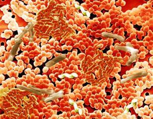Clostridium Difficile Enfeksiyonu Hakkında Bilinmesi Gerekenler