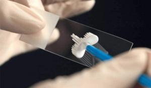 Pap Smear Testi Hakkında Bilinmesi Gerekenler