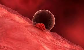 Endometrial Kalınlık Nedir? Belirtileri ve Tedavi Şekilleri Nelerdir?
