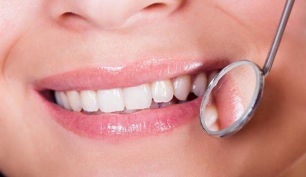 Diş Dolgusundan Sonra Yaşanması Olası Problemler