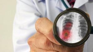 Koronavirus Nedir,  Neye Sebep Olur, Nasıl Korunmak Gerekir?