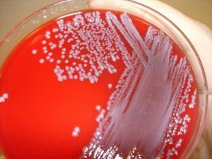 Klebsiella Pneumoniae Nedir?