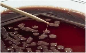 Klebsiella Pneumoniae Nedir?
