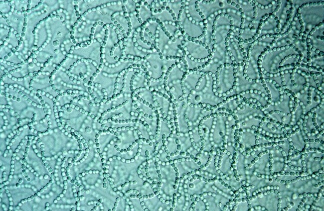 Siyanobakteriler (Mavi-Yeşil Algler) Nedir?