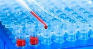 Reverse T3 Testi (Ters T3 Testi) Nedir, Düşük ve Yüksek Seviyeler Ne Anlama Gelir?