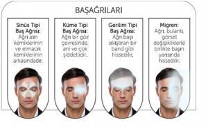 Baş Ağrınız Migrenden mi Kaynaklanıyor?