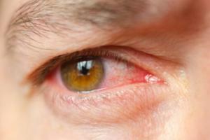 Fizostigmin Nedir?