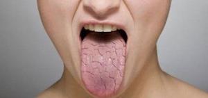 Fizostigminin Kullanım Alanları