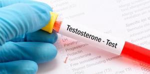 Testosteron Hormonu