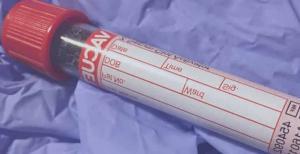 Prolaktin Kan Testi Nedir, Yüksek ve Düşük Seviyelerin Nedenleri Nelerdir?