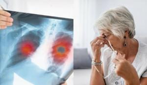 Oksidatif Stres Nedir, Serbest Radikallerin Sağlığa Etkisi Var mıdır?