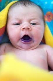 Kristal Violet (Gentian Violet) Nedir, Fonksiyonu ve Riskleri Nelerdir?
