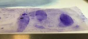 Kristal Viyolen'in (Gentian Violet)  Sağlık Açısından Faydaları