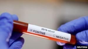 Coronavirus: Orta, Şiddetli ve Kritik COVID-19 Nedir?