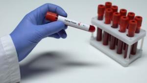 Lipopolisakkaritler (LPS) Nedir?