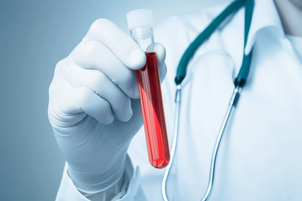 MPV Kan Testi Nedir, Yüksek ve Düşük Seviyeleri Ne İfade Eder?