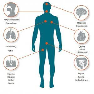 Histamin Nedir? Histamin İntoleransının Belirtileri, Tanı ve Tedavisi