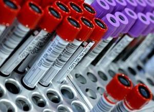 Seks Hormonu Bağlayıcı Globulin (SHBG) Nedir?