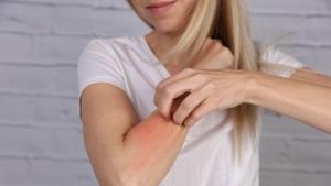 Histaminin Sağlık Açısından Etkileri