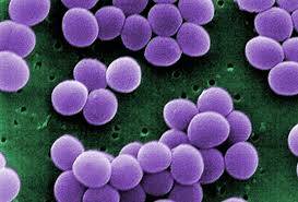İnflamasyonla Antimikrobiyal Peptidler Virüsler Nasıl Savaşır?