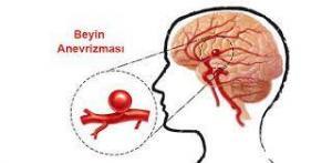 Willis Çemberi: Diyagram, Anatomi  ve Fonksiyonlar