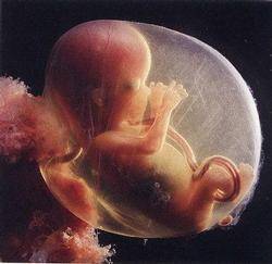 İntrauterin Fetal Ölüm: Sebepler ve Belirtileri