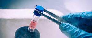Pluripotent Kök Hücreler Nelerdir?