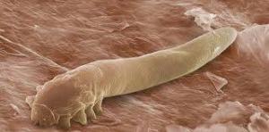 Demodex Nedir, Neye Sebep Olur, Nasıl Tedavi Edilir?