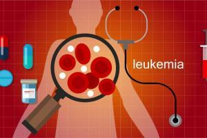 Akut Miyeloid Lösemi: Nedenleri, Belirtileri, Çeşitleri, Tanı ve Tedavi Yöntemleri