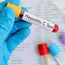 Hepatit C Hastalığı ve Böbrek Nakli Üzerine Merak Edilenler