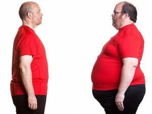 Gastrik Bypass Ameliyatı ile İlgili Bilinmesi Gerekenler