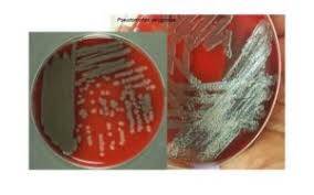 Pseudomonas Enfeksiyonları Nelerdir?