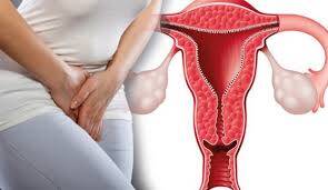 Endometrit (Rahim İçi İltihabı) Nedir?