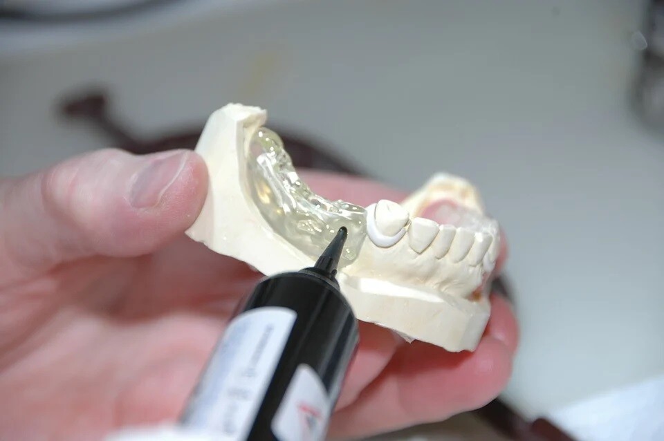 Diş Protezi Yaptırmadan Önce Bilinmesi Gerekenler