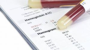 Hemogram Testi (Tam Kan Sayımı) Nedir?
