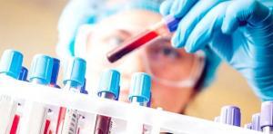 Hemogram Testi (Tam Kan Sayımı) Nedir?