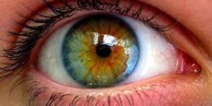 LASIK Nedir?