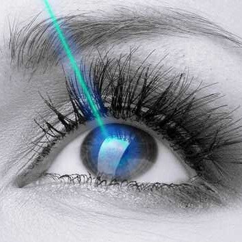 LASIK Göz Ameliyatının Komplikasyonları, Sonuçları ve Riks Faktörleri