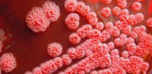 Melioidoz (Melioidosis) Nedir?