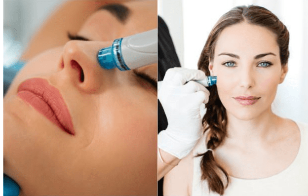 Hydrafacial ile Tertemiz ve Pürüzsüz bir Cilt