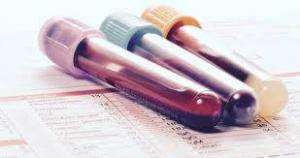 Birincil Biliyer Kolanjit (PBC) Nedir?