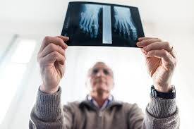 Terzinin Bunyonu (Bunyonet) Nedir?
