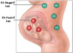 Üçüncü Trimesterde Ultrason Görüntülemenin Faydaları